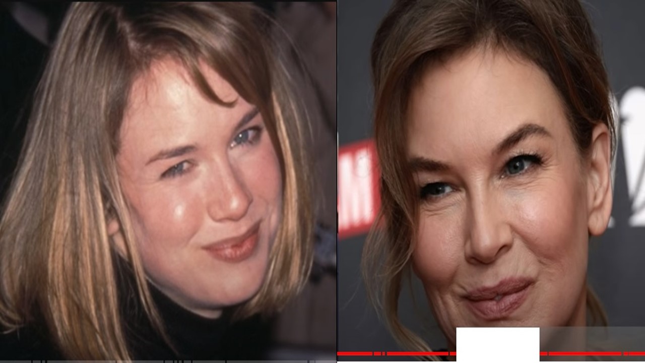 has-renee-zellweger’s-facial-transformation-been-fueled-by-time,-weight-loss,-or-cosmetic-enhancements?