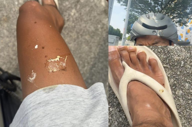 Singaporeans have a laugh after cyclist shares photos of pigeon droppings on him while out on his bike